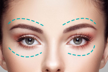 BLEFAROPLASTIA-TJ-PLAST