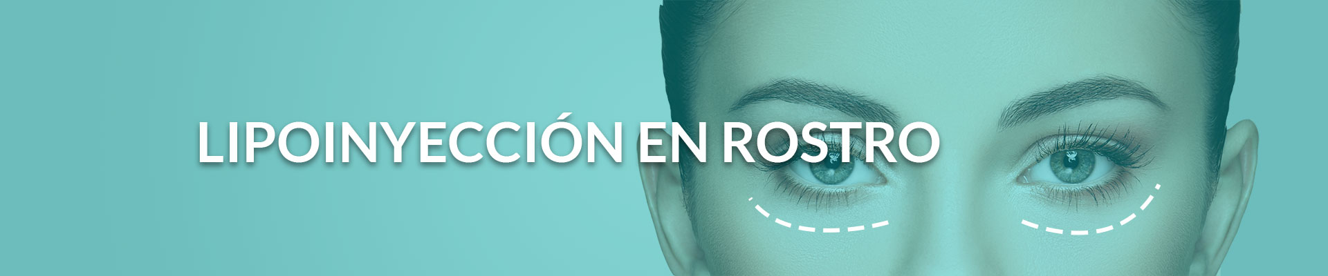 LIPOINYECCION-EN-ROSTRO-tj-plast lipoinyección en rostro